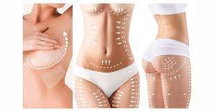 Mommy Makeover: Getting Your Body Back After Pregnancy in Miami